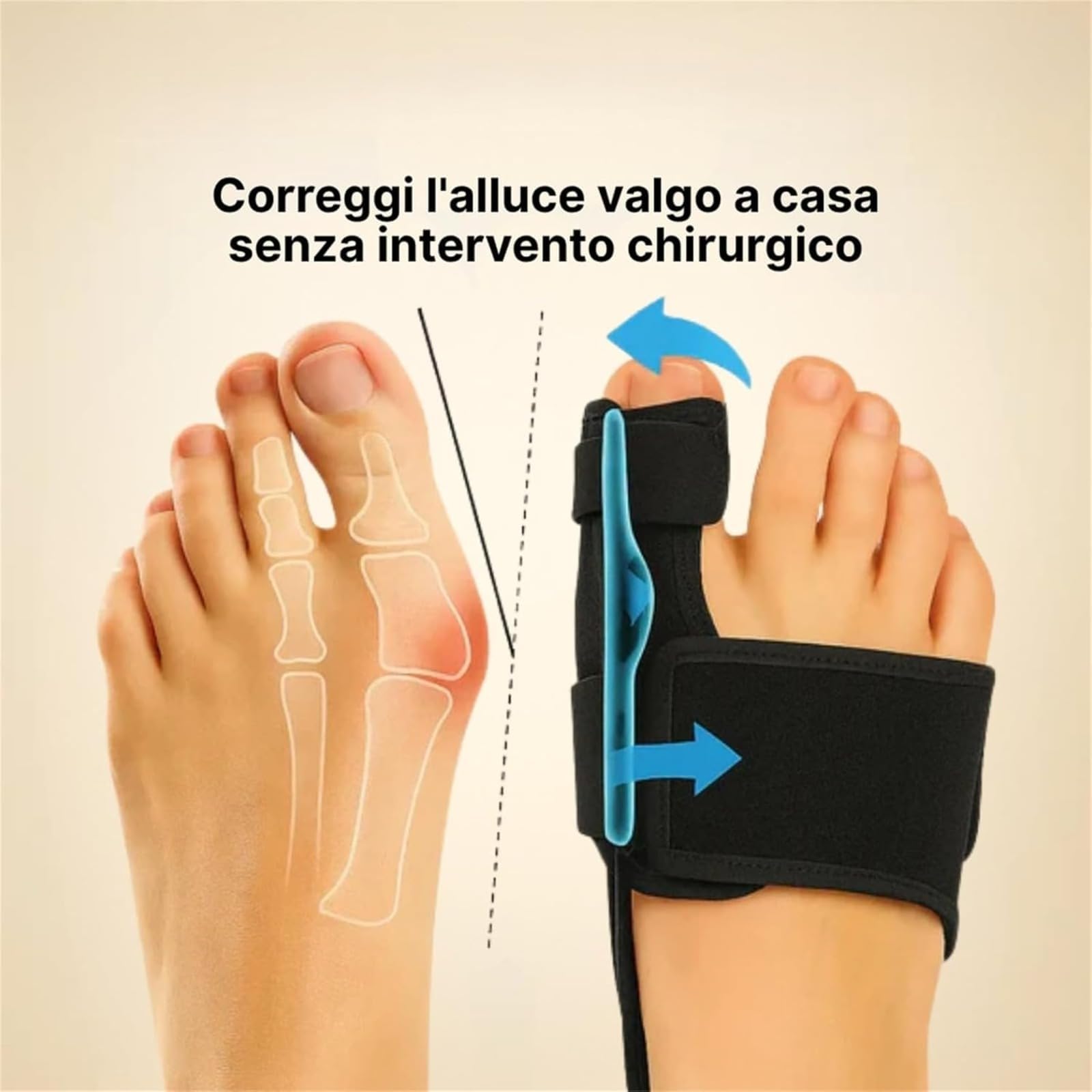 Hallux Valgus Korrektur Zehenspreizer Haltungshelfer Schiene ValgusVita Nächtliche Zehenkorrektur für schmerzfreie Füße, Bequeme Polsterung Verstellbarer Riemen für Herren Damen