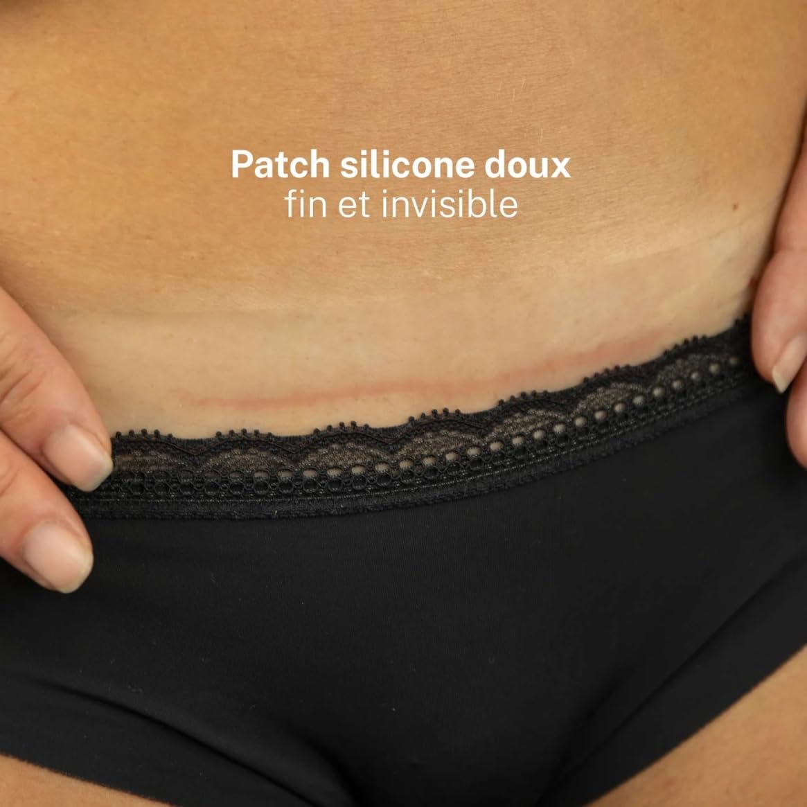 Melicare Patch Médical Siliconé Enrichi en Vitamine E x3 4x22cm