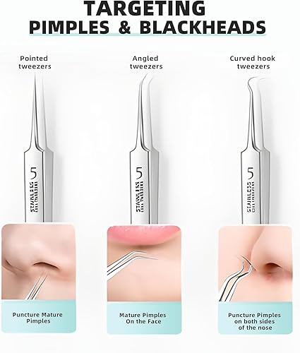 Miniatura 5 de Kit de herramientas de eliminación de puntos negros, herramienta extractora de puntos negros, pinzas de espinillas de acero inoxidable, kit de