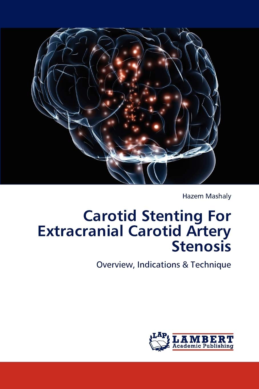 Snapklik.com : Carotid Stenting For Extracranial Carotid Artery ...