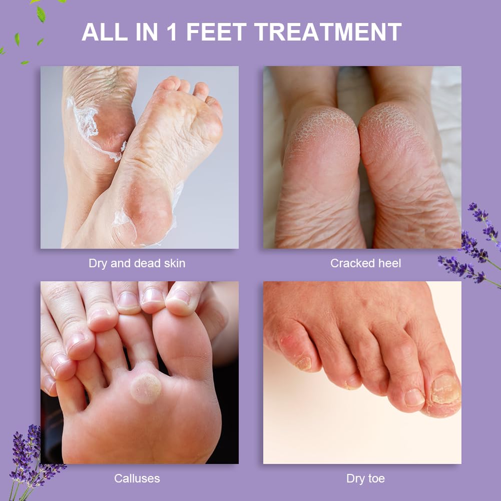 ACWOO Maschera Piedi Esfoliante, 4 paia Maschera Peeling Piedi， Maschera per Piedi Efficace Cura dei Piedi i Scrub Piedi, Maschera Esfoliante Rimozione calli e Pelle Morta piedi