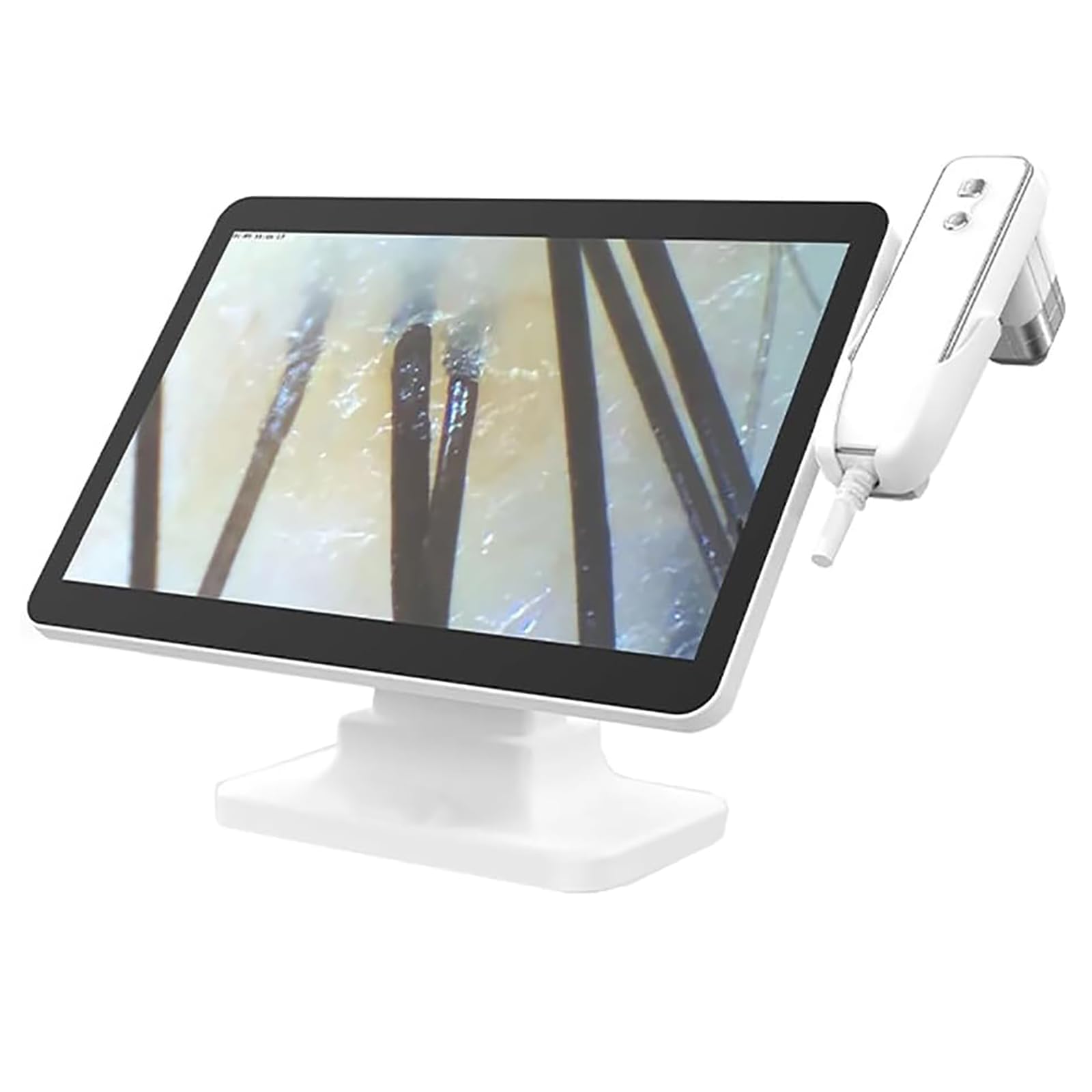 Skin Hair Analyzer, 10 Million Pixel Hair Follicle Detector, Equipped with 14.1 In Screen, 50x/200x Magnification Probe, 16G File Storage-4 Grid Contrast, Suitable for Beauty Salons, Spas