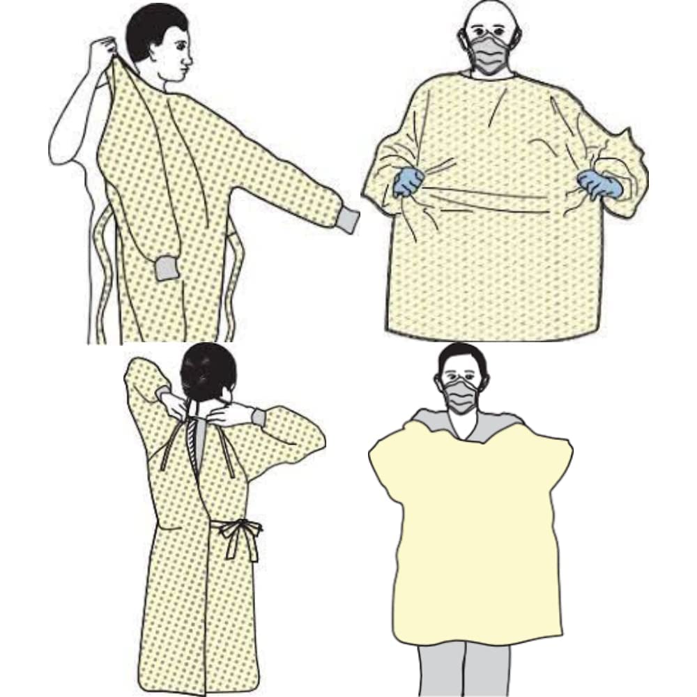 Blouses de protection à usage unique bleu non tissée jetable - Pour les professions hospitaliers et de soins (100)