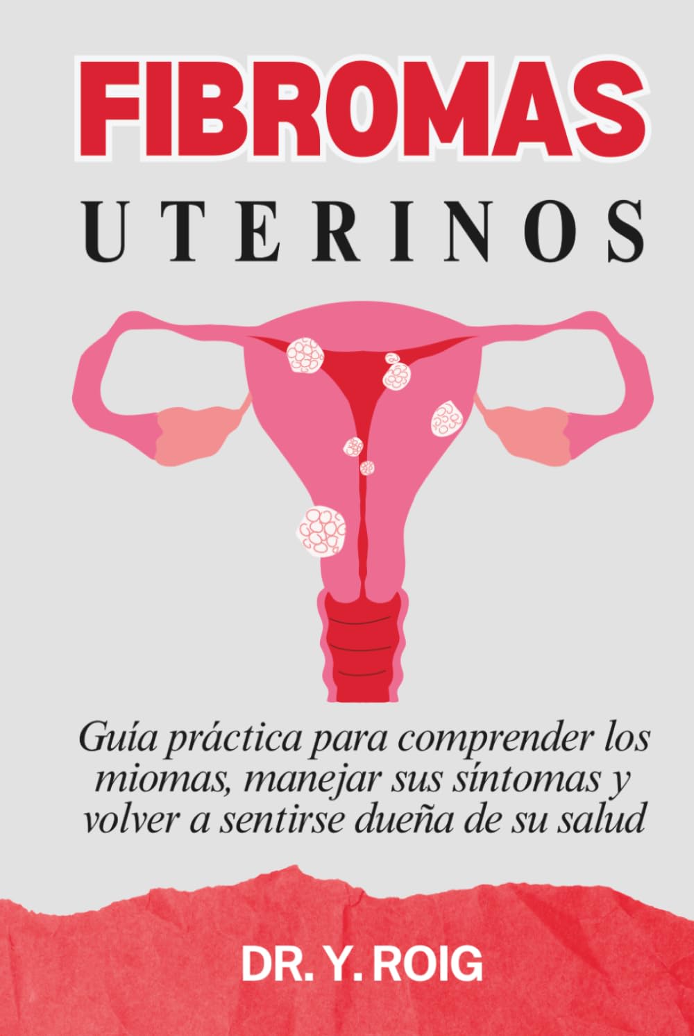 Fibromas uterinos: Guía práctica para comprender los miomas, manejar sus síntomas y volver a sentirse dueña de su salud