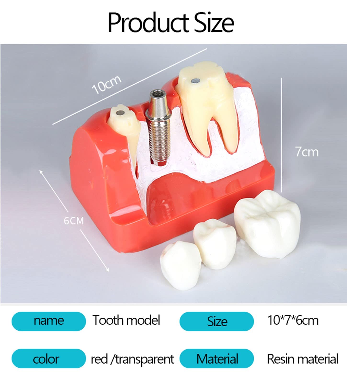 Amazon.co.jp: 取り外し可能歯列模型 樹脂歯の模型 歯科インプラント
