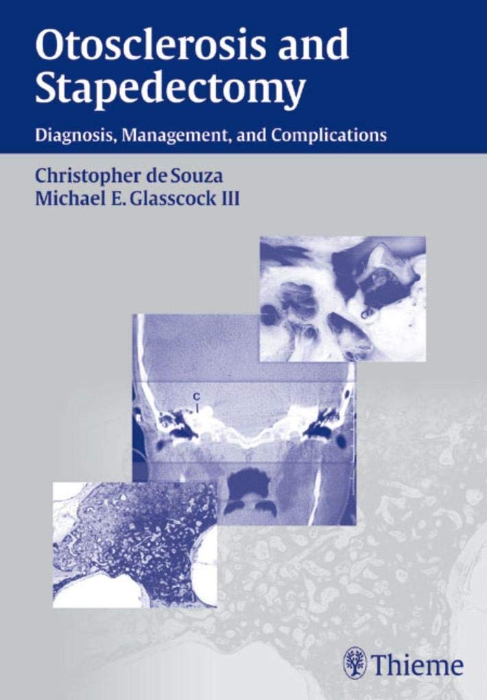 Buy Otosclerosis and Stapedectomy: Diagnosis, Management & Complications — BookShops.in