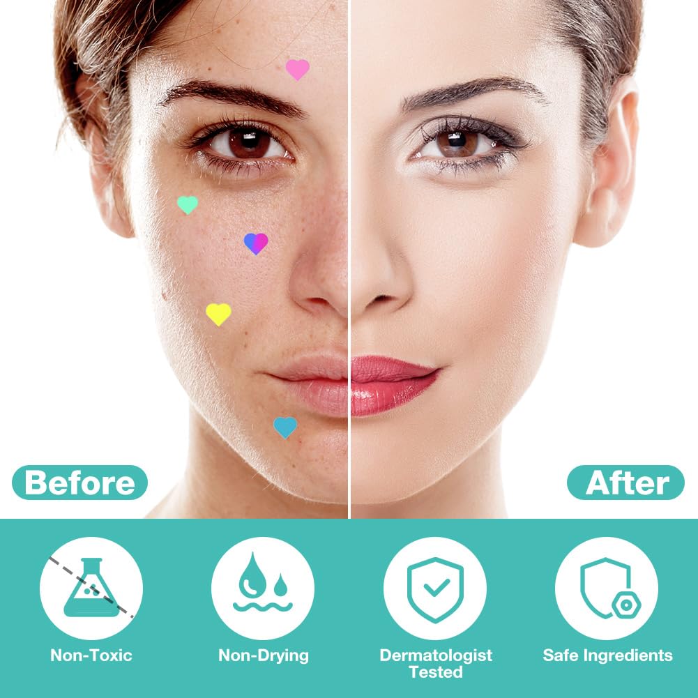 BUTBU Pimple Patches, 400 Pieces Heart Hydrocolloid Spot Patches, Mighty Blemish Patches - Image 3