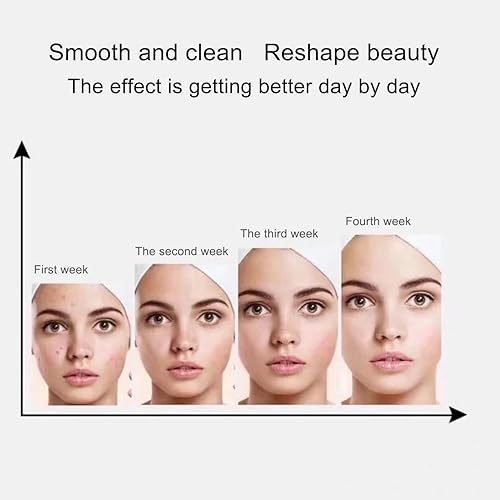 Miniatura 7 de bonnybeauty AS1 SA2 AO3 Salón de belleza profesional Dermoabrasión solución facial Cuidado de la piel Aqua Peeling Suero para máquina facial 13.5 fl