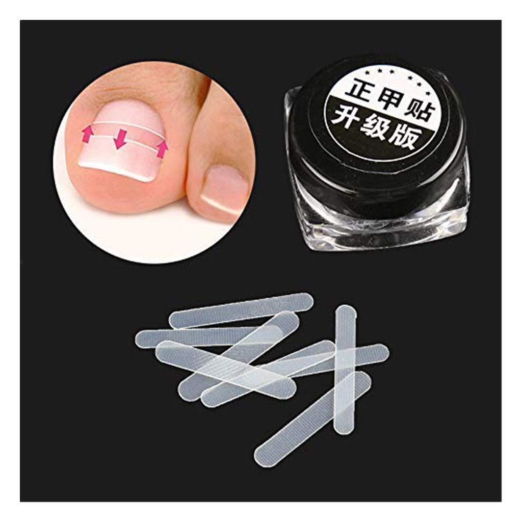 Uteruik Ingrown Toenail Pedicure Tool Straightening Clip Curved BS Brace Toenails Thick Paronychia Correction Tool Foot 10pcs