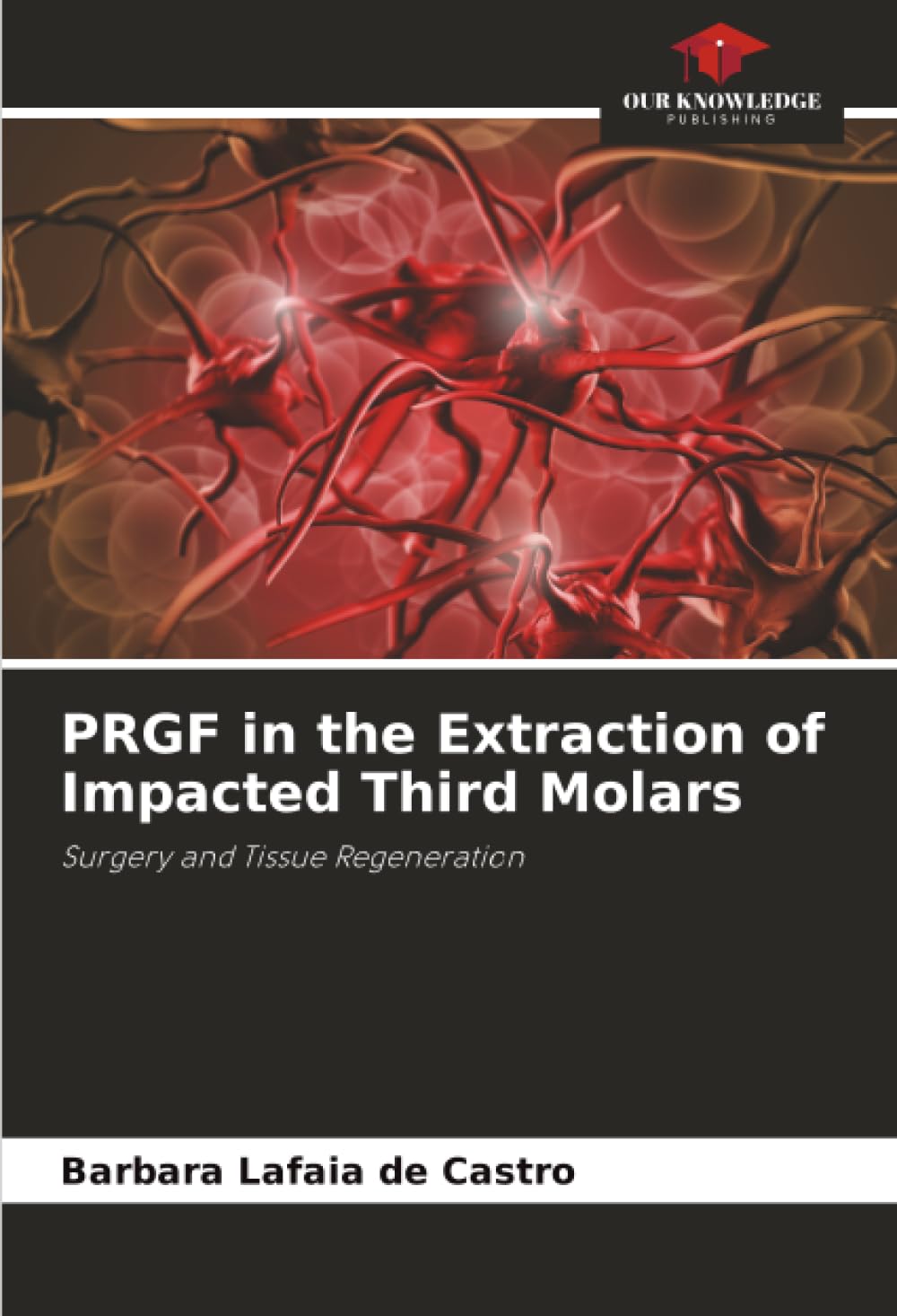PRGF in the Extraction of Impacted Third Molars: Surgery and Tissue Regeneration
