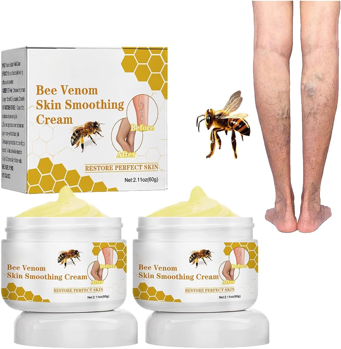 2PC Bee Venom Varicose Relief Veins Cream, Furzero Bee Venom Treatment