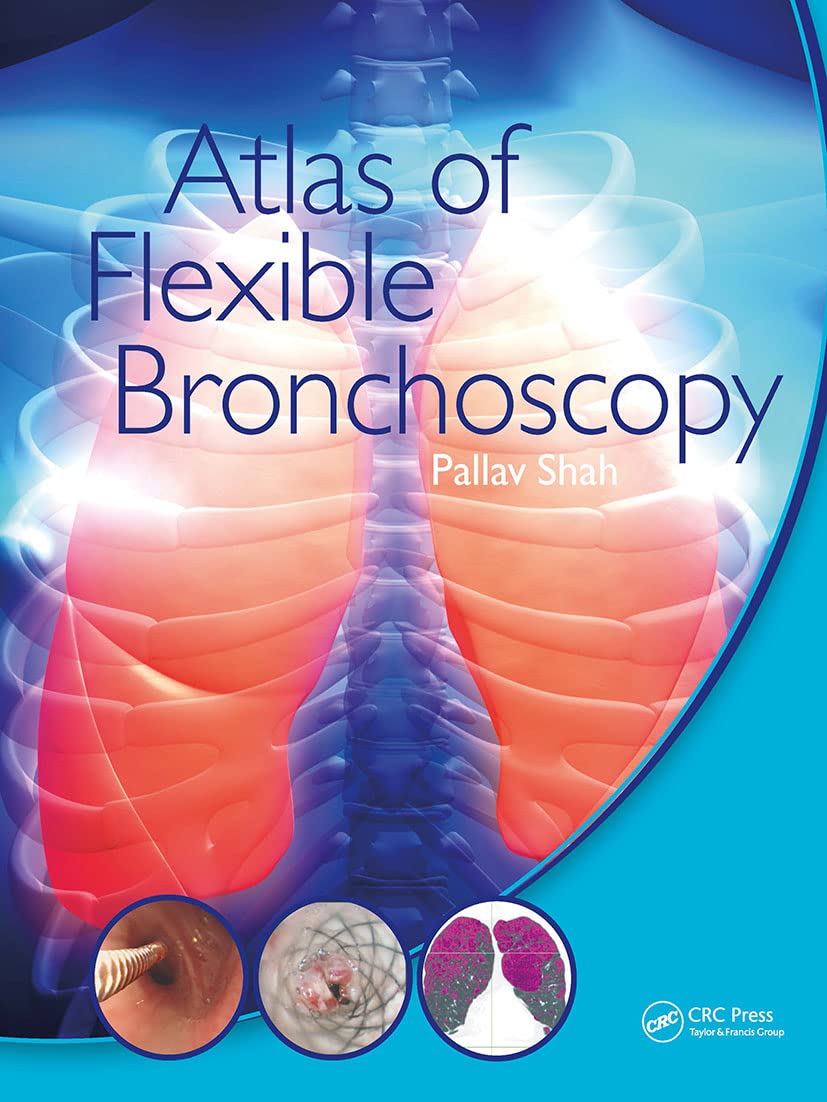 Atlas of Flexible Bronchoscopy      1st Edition