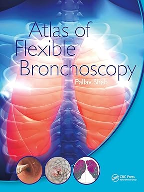 ATLAS OF FLEXIBLE BRONCHOSCOPY (PB 2022)