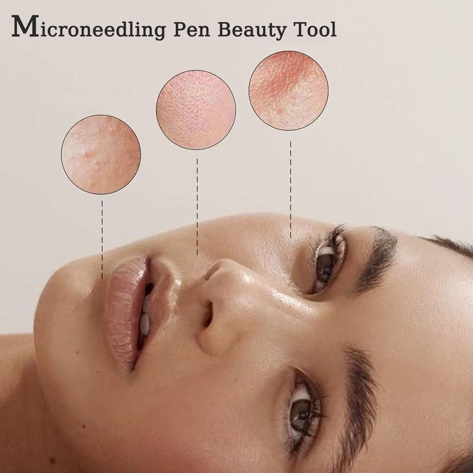 Derma Roller Pen 0.25mm, Microneedling Pen Beauty Tool for Hair Face Scalp Beard Skin Care At Home Use