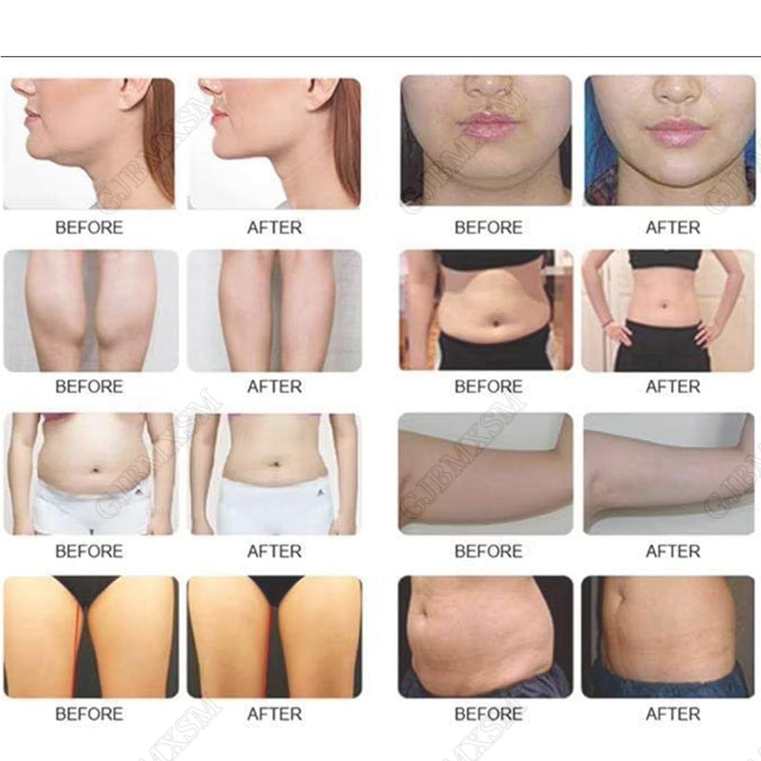 Fett Einfrieren Kryolipolyse Gerät, Professionelle Abnehmen Maschine Körper-Kryolipolyse-Vakuum für Gewichtsverlust, Fett Abbau, Cellulite verringern,Körperformung