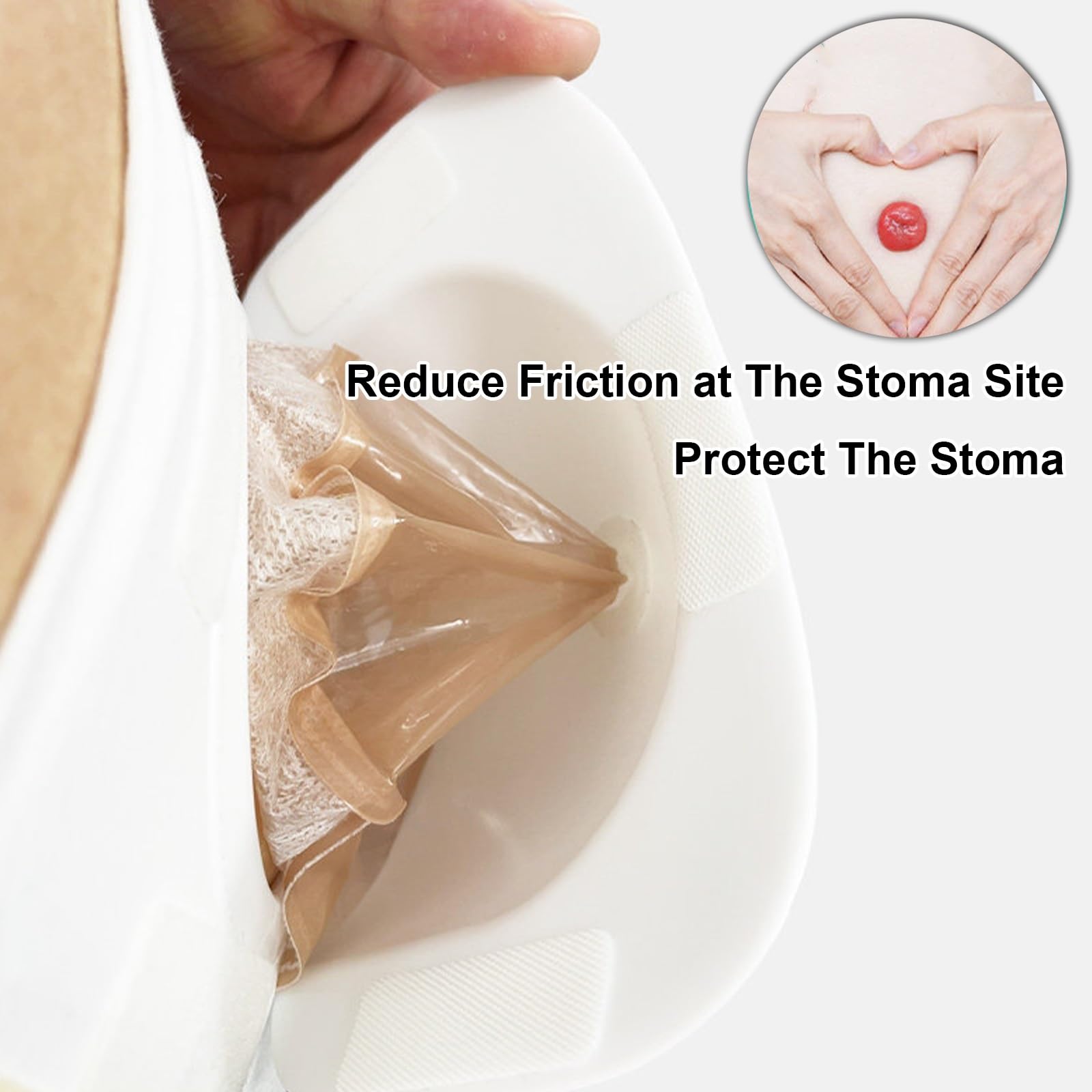 Verstellbare Stoma Bandage, Atmungsaktiver Stoma Gürtel, Beugt Parastomalen Hernien vor, Postoperativer Stomagürtel Zum Schutz Des Stomabeutels(Medium)