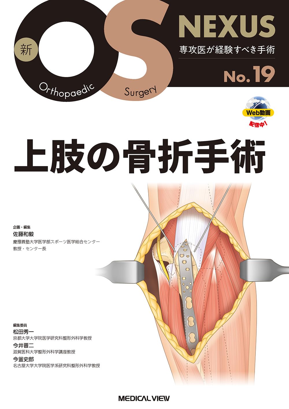 上肢の骨折手術 (新OS NEXUS No.19) | 佐藤 和毅 |本 | 通販 | Amazon