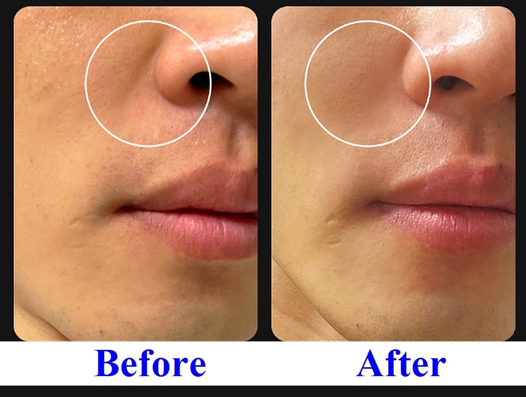 ―(0.7 onzas / paquete de 2, 0.35 onzas cada uno) [Volufiline (20%) Extra Lift] suero facial en barra – Suavizante de arrugas manos libres y volumen facial, cara, cuello, escote 7