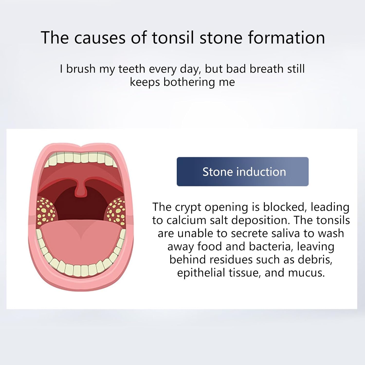 Electric Tonsil Stone Remover Kit, 3-Suction Mode Oral Cleaner with LED Light, Rechargeable Tonsil Cleaning Tool for Bad Breath and Throat Hygiene