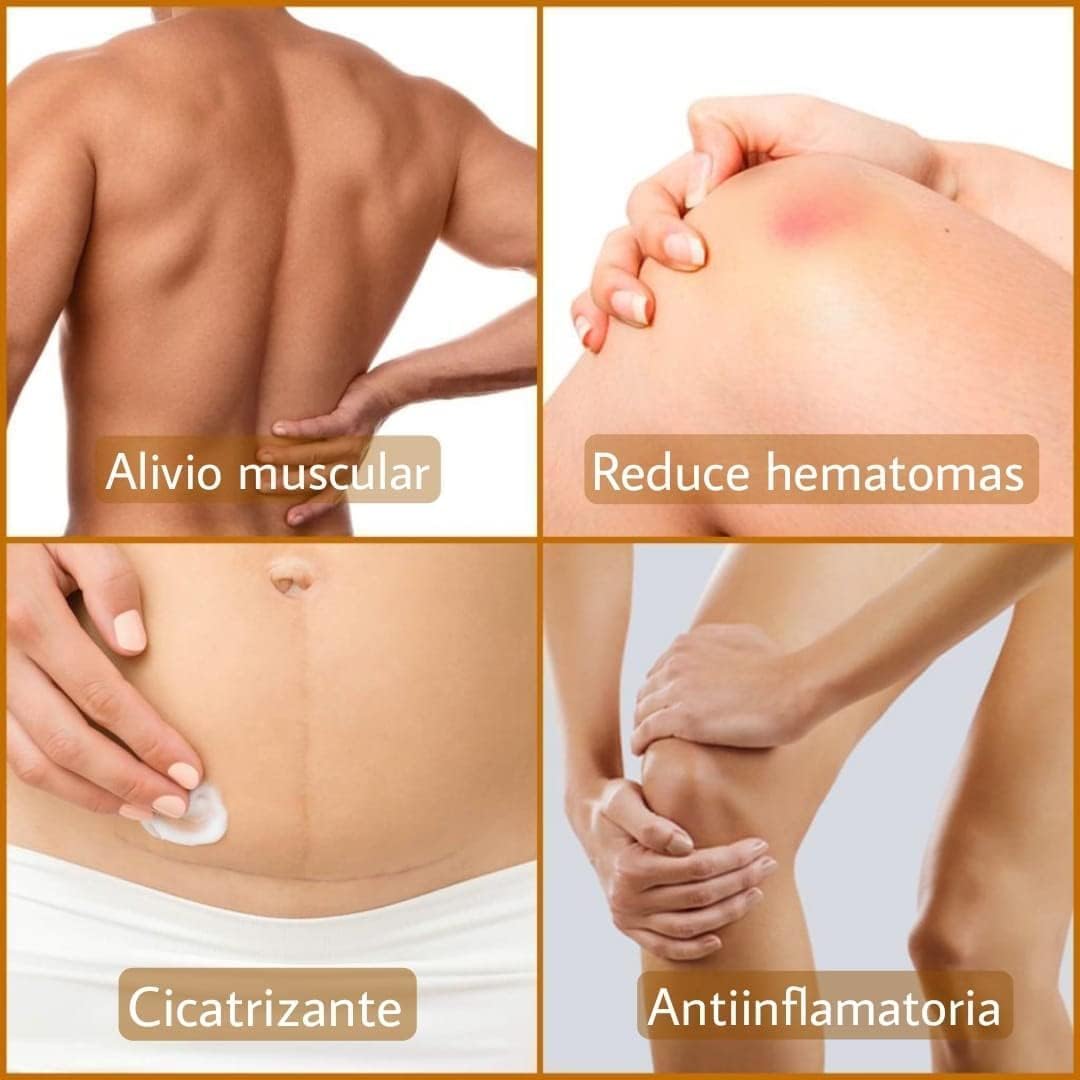 Sin Dolor Crema Arnica 2 Unds [ Alivia El Dolor En Articulaciones Golpes Artrosis Huesos y Musculos Relaja las Piernas Cansadas e hinchadas Fabricado en Alemania 250ml X 2 Unds
