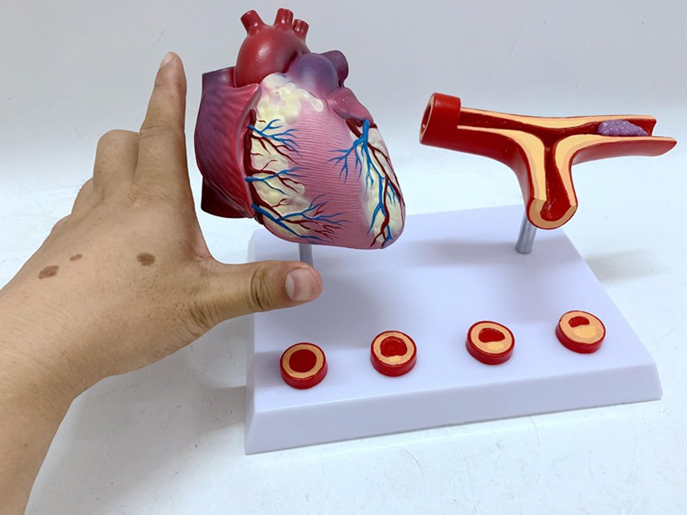 Narzędzia do nauki modelu, nauczanie anatomii serca serca pomostowanie tętnic wieńcowych model z blokadą tętnic i naczyń krwionośnych zakrzepica pomoce dydaktyczne
