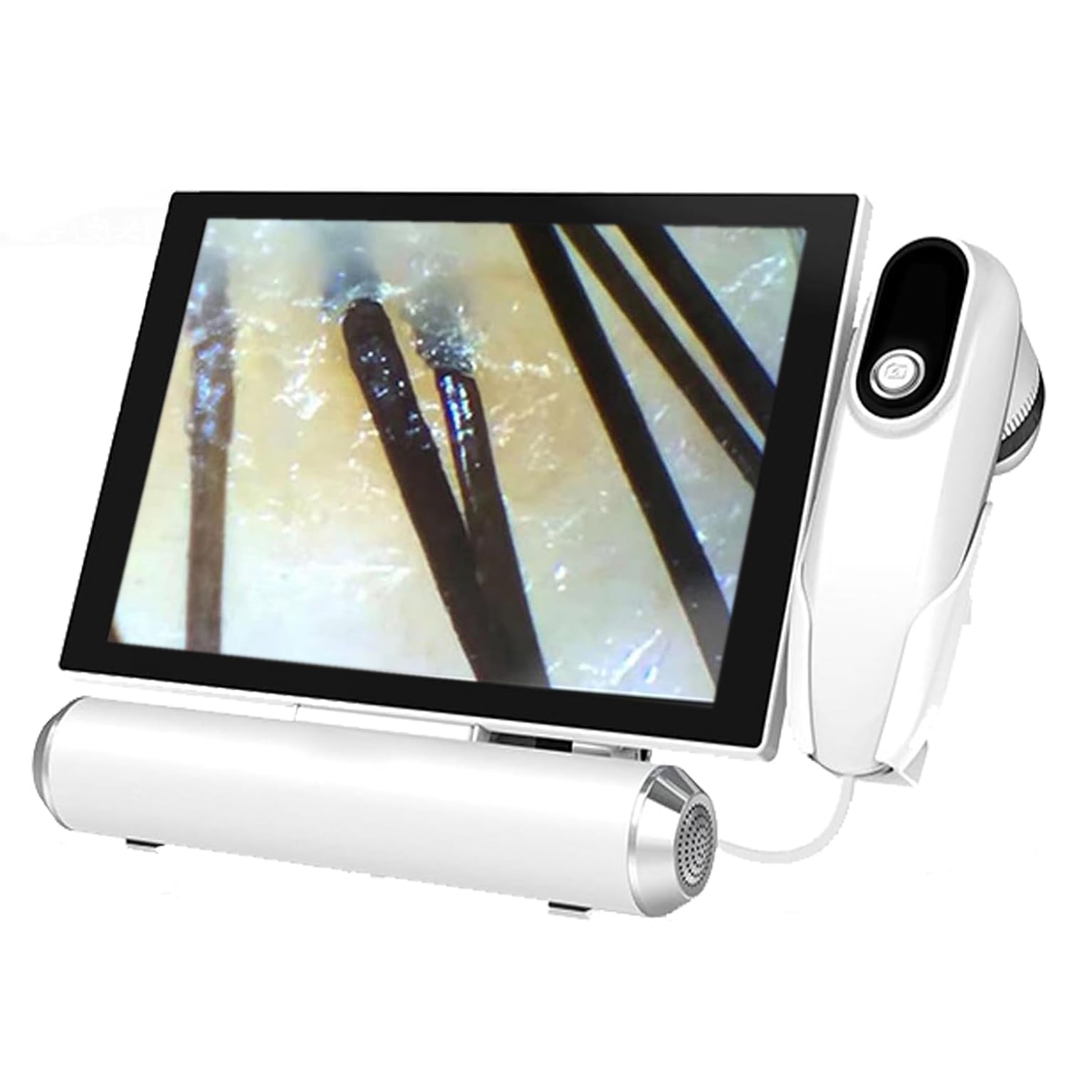 Diagnóstico De La Piel Analizador Capilar, Detector De Folículos del Cuero Cabelludo con Lentes 50X Y 200X, Pantalla LCD De 11 Pulgadas, Imágenes De Alta Definición, para Rostro