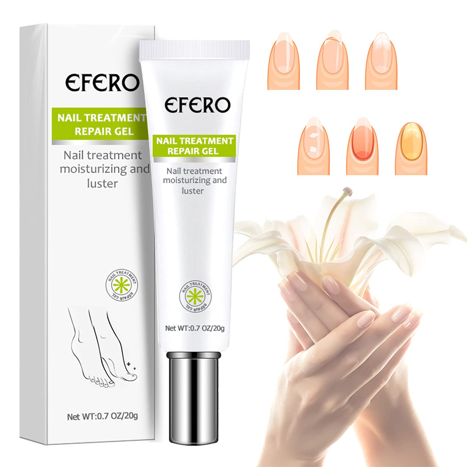 Toe Be Health Instant Beauty Cream,Cure Damaged Foot & Toenails, Nail & Toenail Treatment Nail Repair Cream,Renews Yellow, Cracked and Split Nails(2Pcs) : Beauty & Personal Care