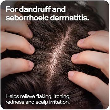 Sons Ketoconazole Anti-Dandruff Treatment Shampoo. Treats & Prevents Dandruff, Itchy Scalp, Seborrheic Dermatitis & Psoriasis. 1 x 60ml. Made in Europe.