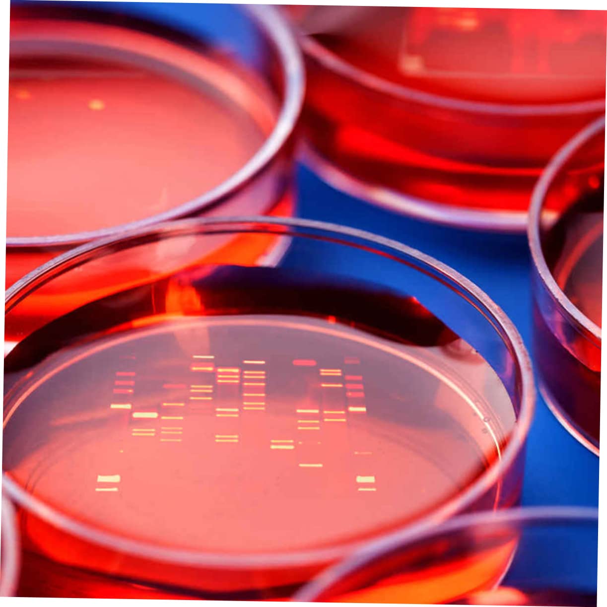 NAMOARLY 30pcs Plastic Petri Dishes Set Lab Dishes Bulk for Culture Lids Window Design