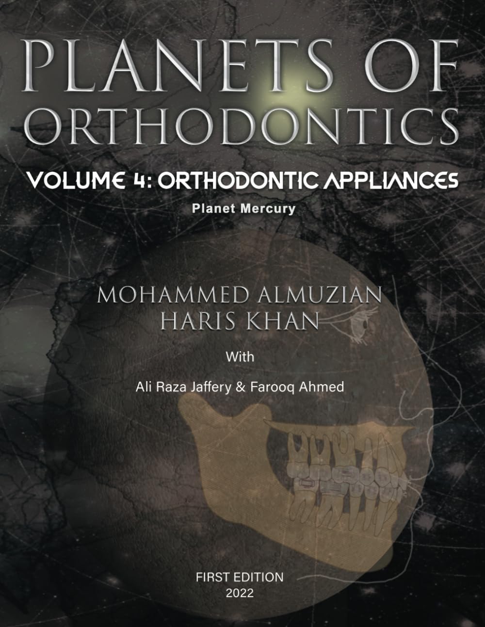 PLANETS OF ORTHODONTICS: Orthodontic Appliances: Volume 4: Planet Mercury
