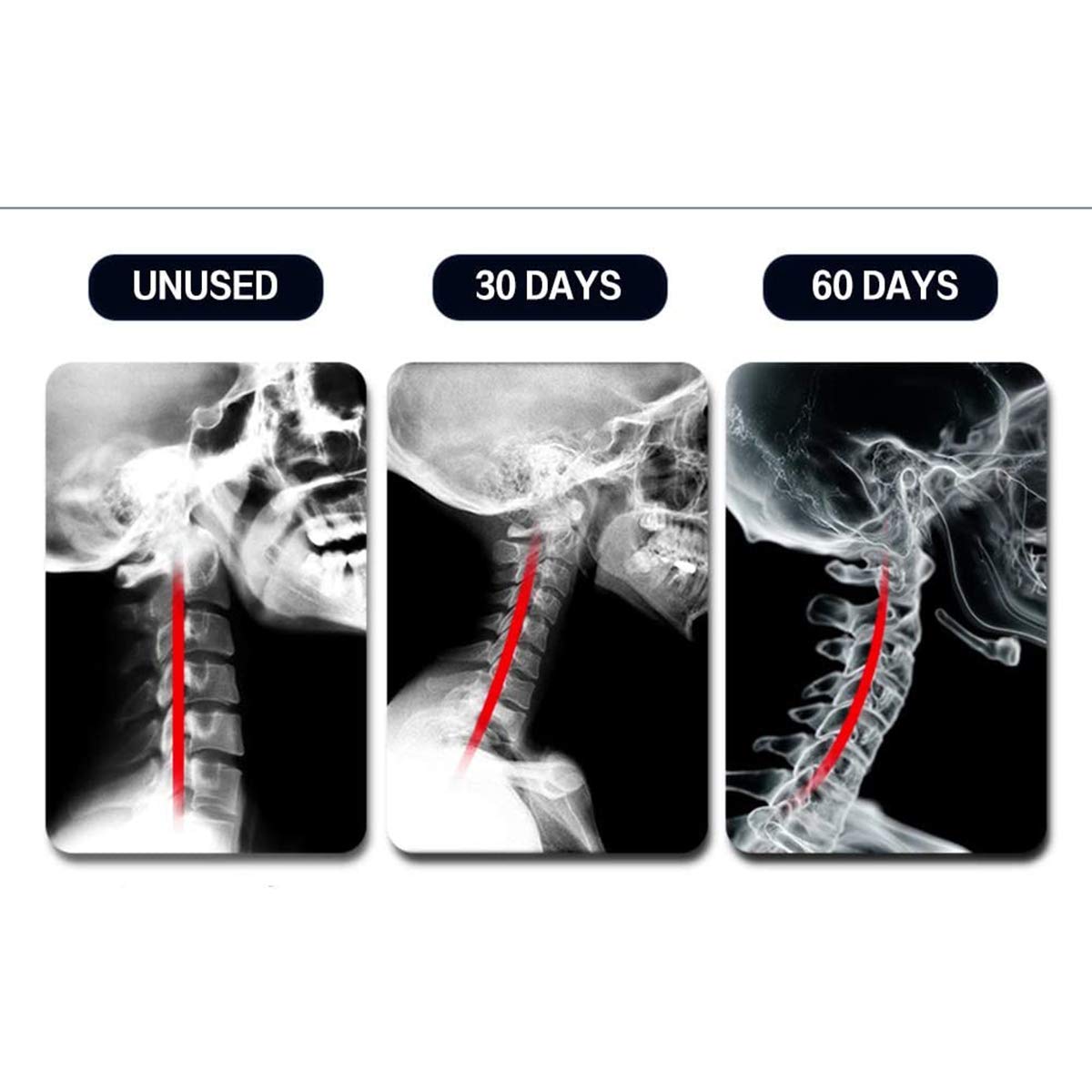Dispositivo di trazione cervicale del Collare del Collare del Collo, Strumento di Fisioterapia, impacco Caldo, Collo Gonfiabile, Tratto di Cura Fisso