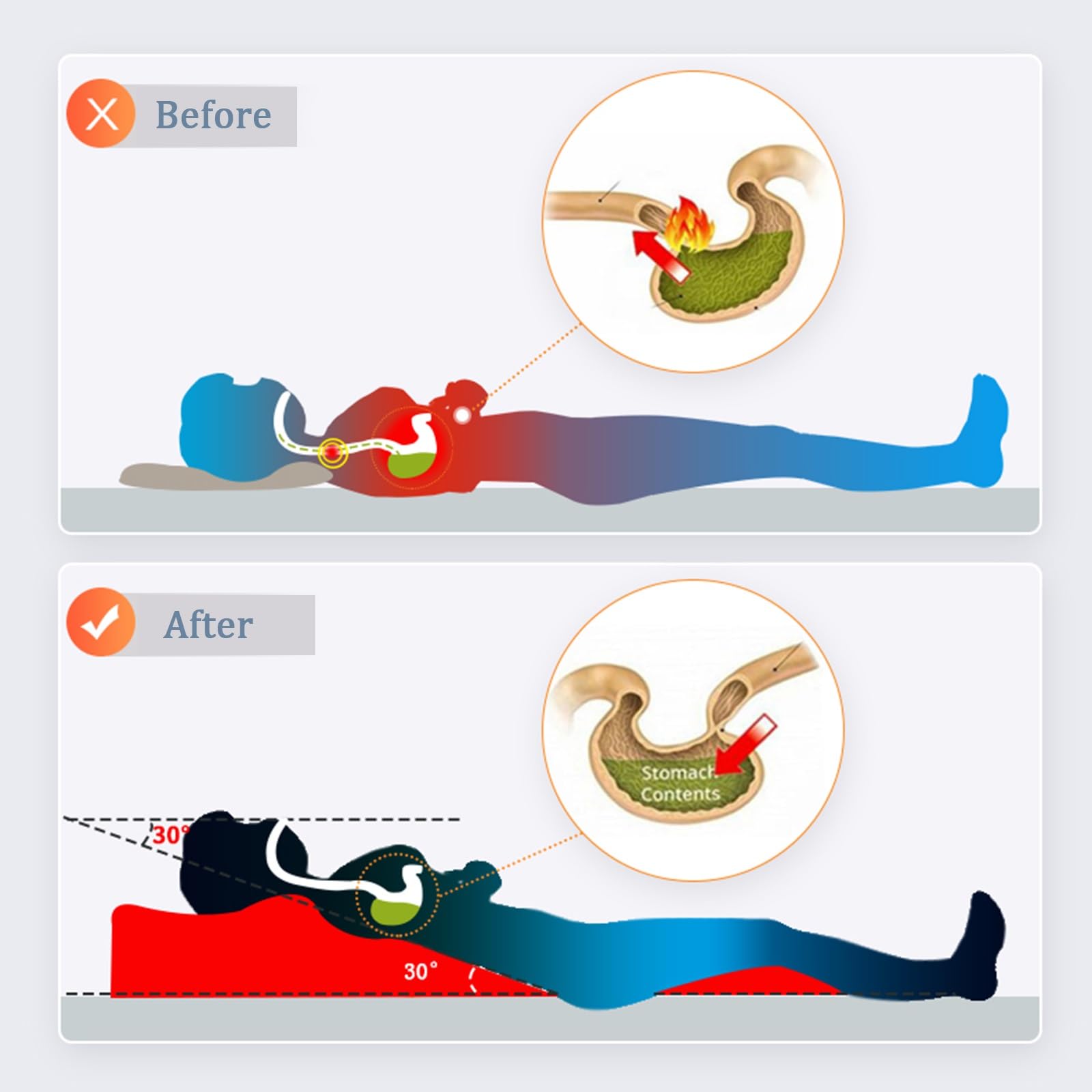 AMUFJJ Cuscino antireflusso Adulti Cuscino a Cuneo Lungo 80 cm, Cuneo da Letto per Dormire con reflusso Acido/Supporto per la Schiena e la Vita, Cunei per Cuscini per Anziani/Adulti/Incinte