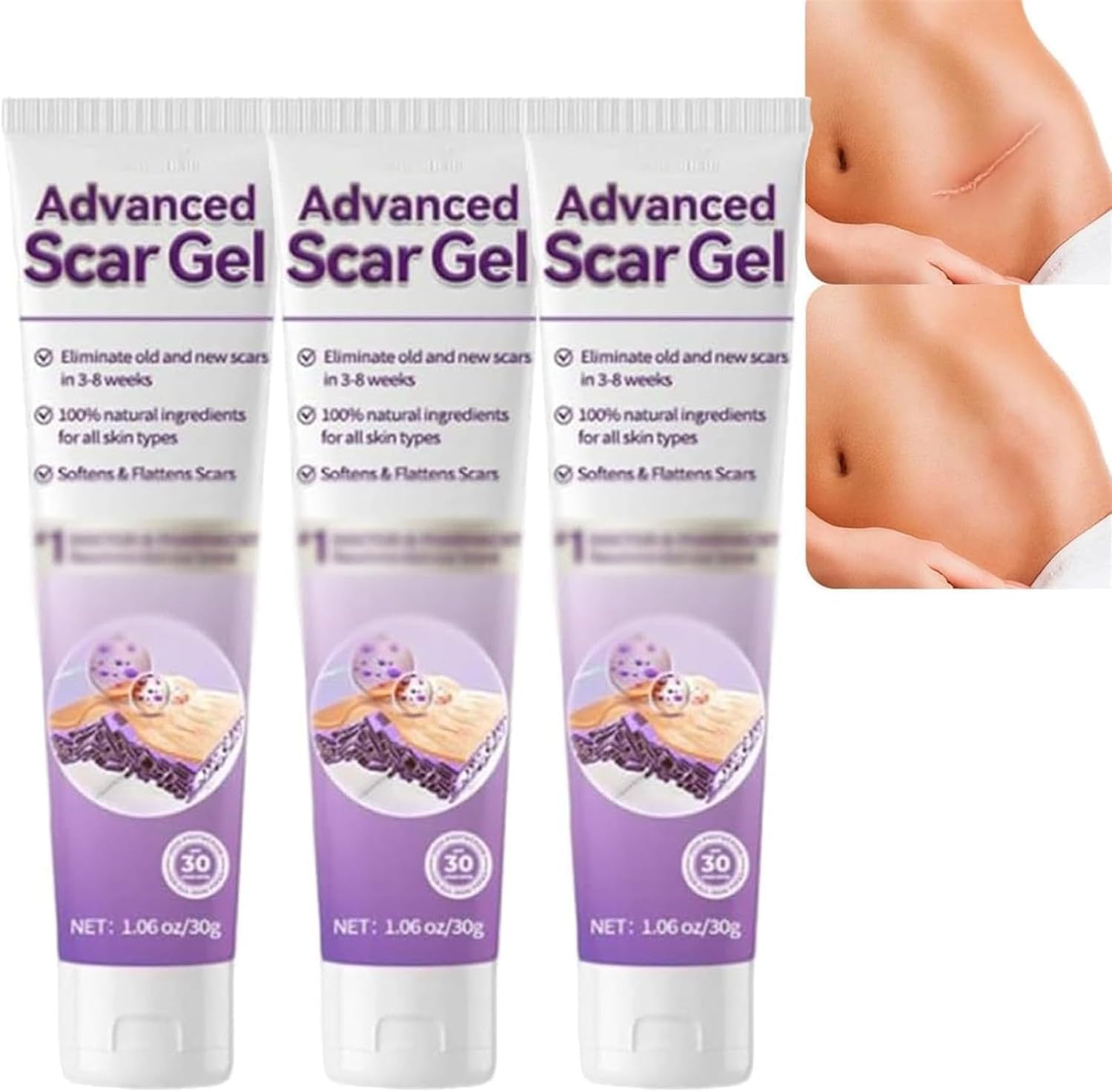 Gel per cicatrici avanzato, 2026 Nuova crema per cicatrici chirurgiche, crema per la rimozione delle cicatrici per tutti i tipi di pelle
