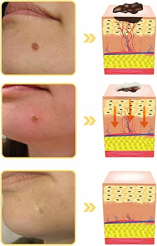 Miniatura 3 de Bee Venom Crema de tratamiento de la piel, eliminación de la piel y cuidado de la piel para cara y cuerpo para todo tipo de piel, rápida y eficaz (1