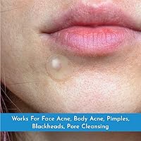 Vista 4 de Truly Clear Paquete de parches para espinillas