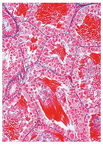 Image of Lieder W5A3B-07 Frog Histology(Rana) 12 Slides Basic Set,Grade: 1 to 1, 1.62 inch Height, 6.37 inch Wide, 10.119999999999999 inch Length