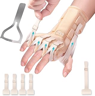 Radial Nerve Palsy Splint Brace for Wrist drop, 5 Fingers Extension, Stroke Patient Recovery, Finger Limp, Crutch Palsy, MCP Arthroplasty, for both Left and Right Hand - Beige