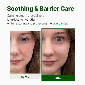 NACIFIC Cica PDRN Barrier Repair Cream, Korean Moisturizer with 76% Centella Asiatica, Skin Barrier Strengthening & Deep Hydration for Dry Sensitive Skin, Low pH Calming Face Cream, 1.76 oz (50g)