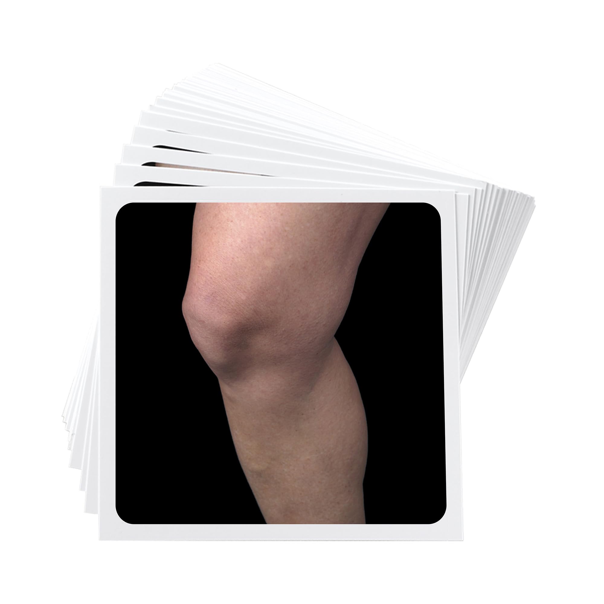 OPTP NOI Recognise Knee Flash Cards— Perform Graded Motor Imagery Techniques to Test Left/Right Discrimination Abilities — Non-Returnable
