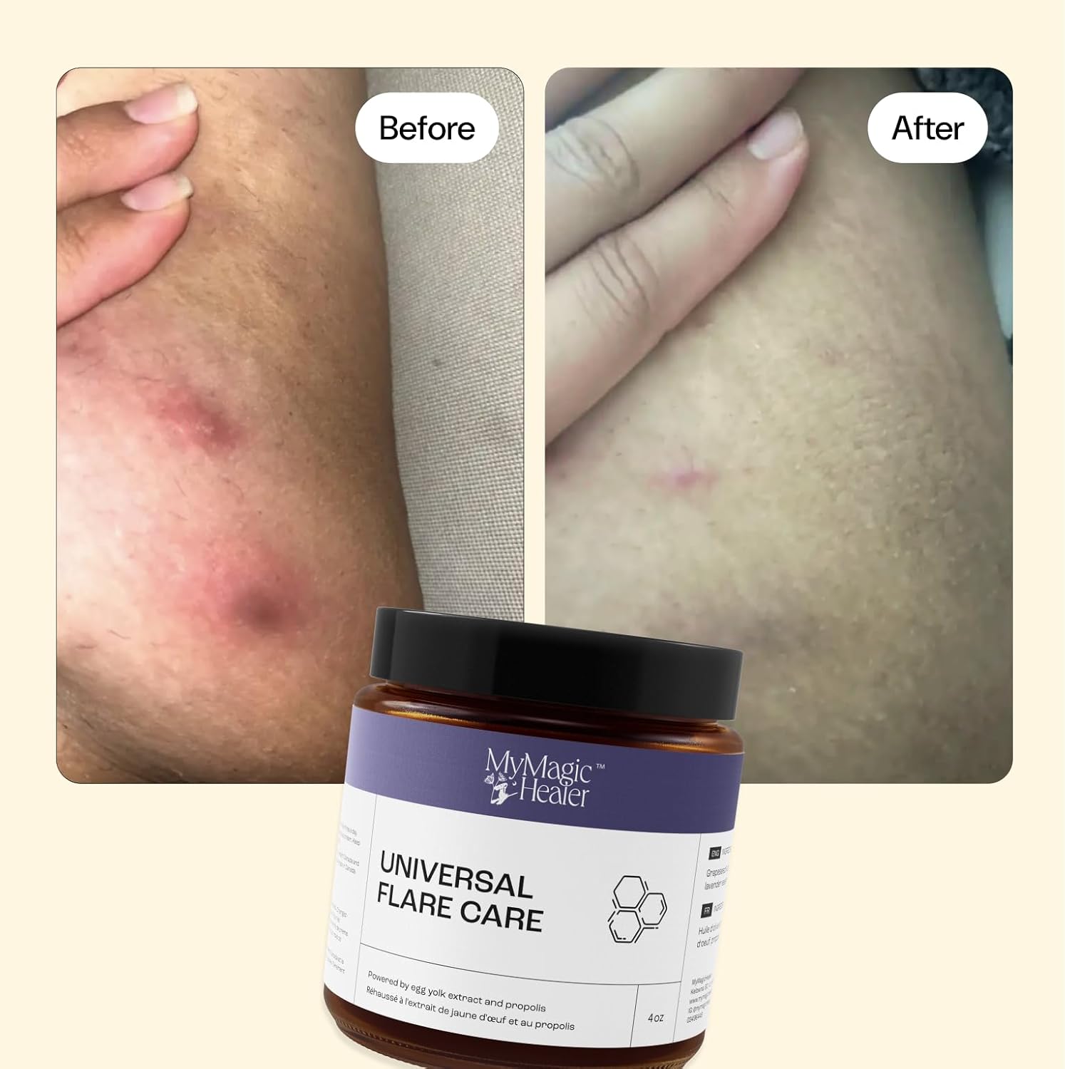MyMagicHealer Mom & Baby Postpartum Skin Care Routine | Diaper Rash, Nipple Chafing, Postpartum Dry Skin Irritation | Essential Oil Free 4 oz + Universal Flare Care 2 oz + Witch Hazel Spray image 4