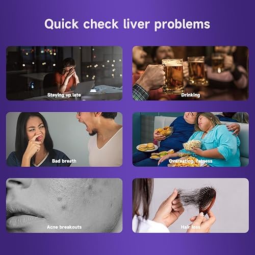 Miniatura 2 de Suplemento de apoyo hepático  Desintoxicación y reparación de limpieza hepática con cardo mariano, cúrcuma, diente de león y alcachofa  Fórmula