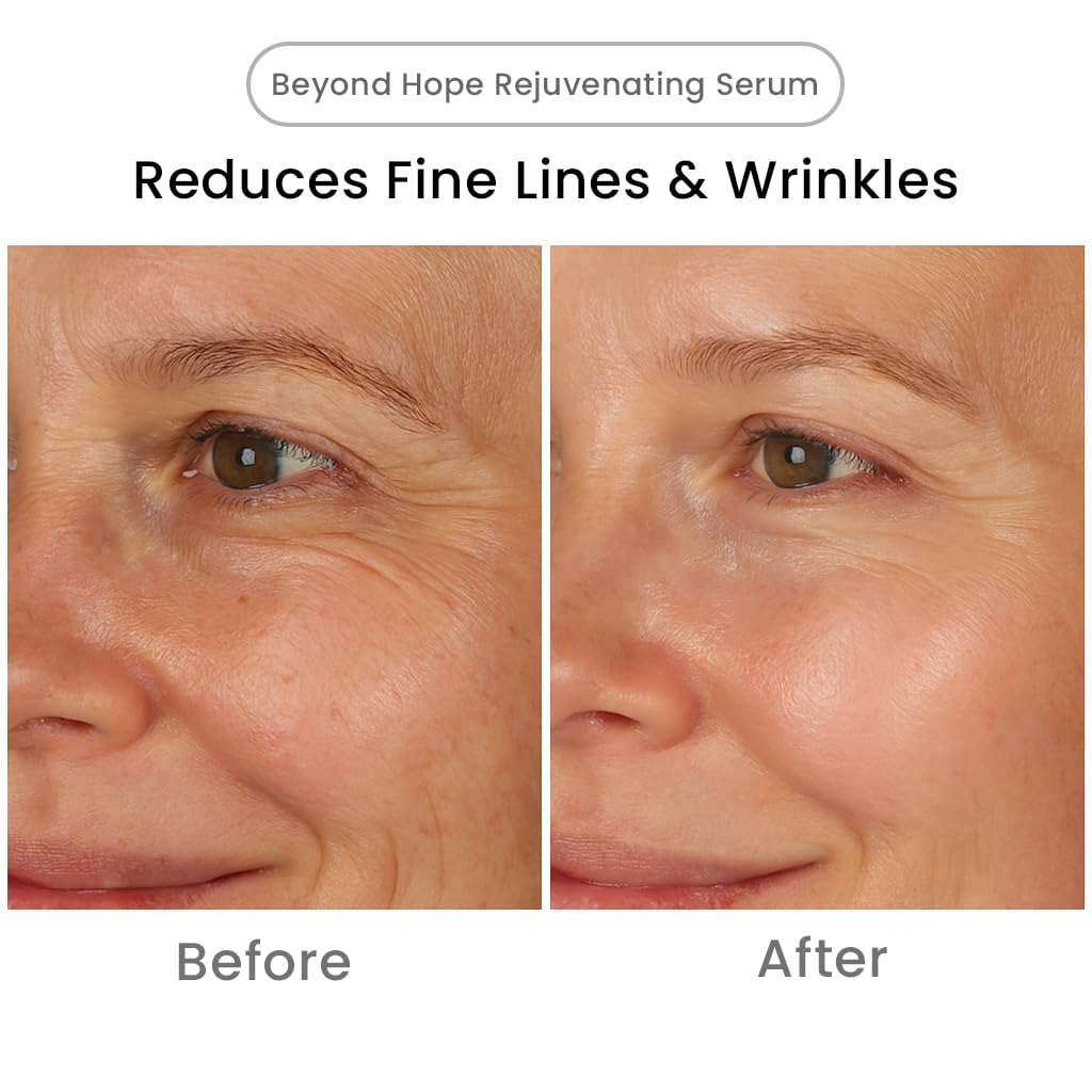 Blaq Beyond Hope Rejuvenating Serum with Niacinamide, Retinol, Pomegranate and Ferments for skin brightening, nourishment and barrier protection with a natural glow. 30ml (1Fl Oz)