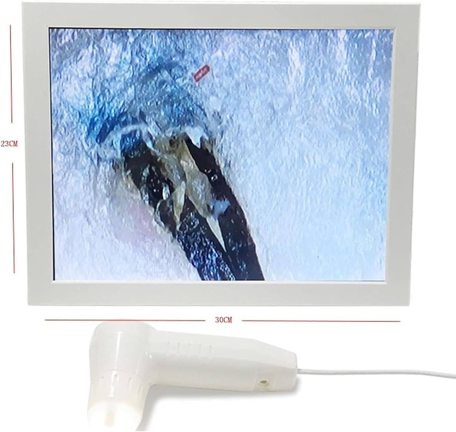 Analizzatore cuoio capelluto follicoli piliferi, schermo 15", zoom 50‑200