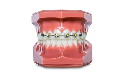 Miniatura 10 de Braces - Soporte alternativo de cera para parachoques, accesorios de ortodoncia para broches, mariposa, 10 unidades