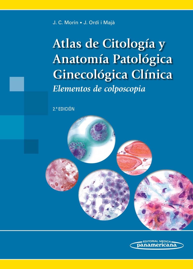 Atlas de Citología y Anatomía Patológica Ginecológica Clínica: Elementos de colposcopia