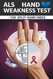 ALS Hand Weakness Test - The Split Hand Index: The split hand index might suggest hand weakness specifically due to ALS. But is it enough to make a diagnosis?