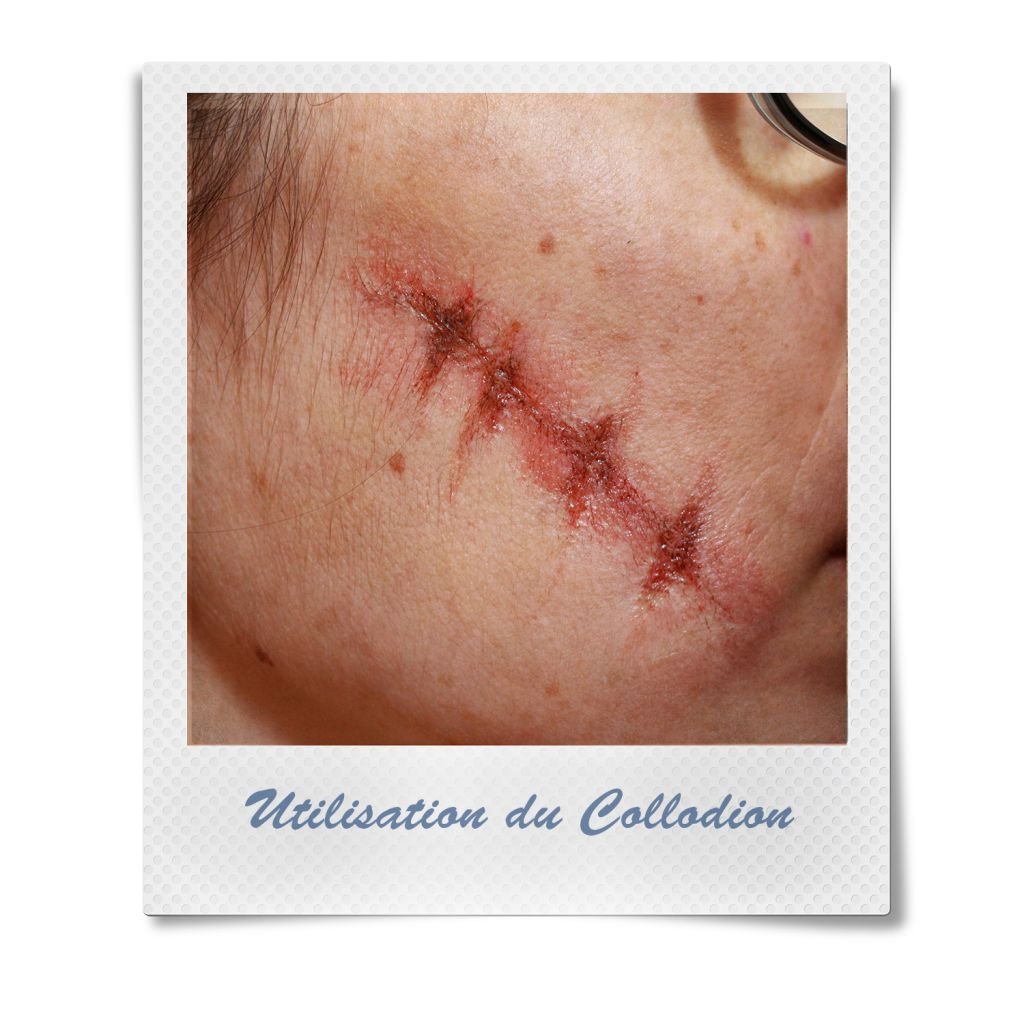 Kryolan Collodio 11 Ml