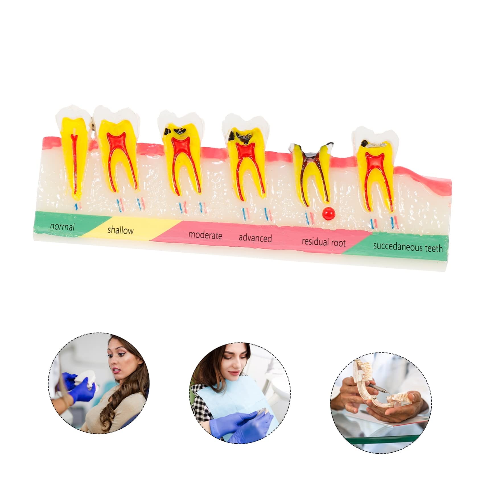 OUNONA Modello Dentale Portatile in Resina per Educazione Orale Aspetto Creativo e Leggero per Scienze e Didattica Dentale