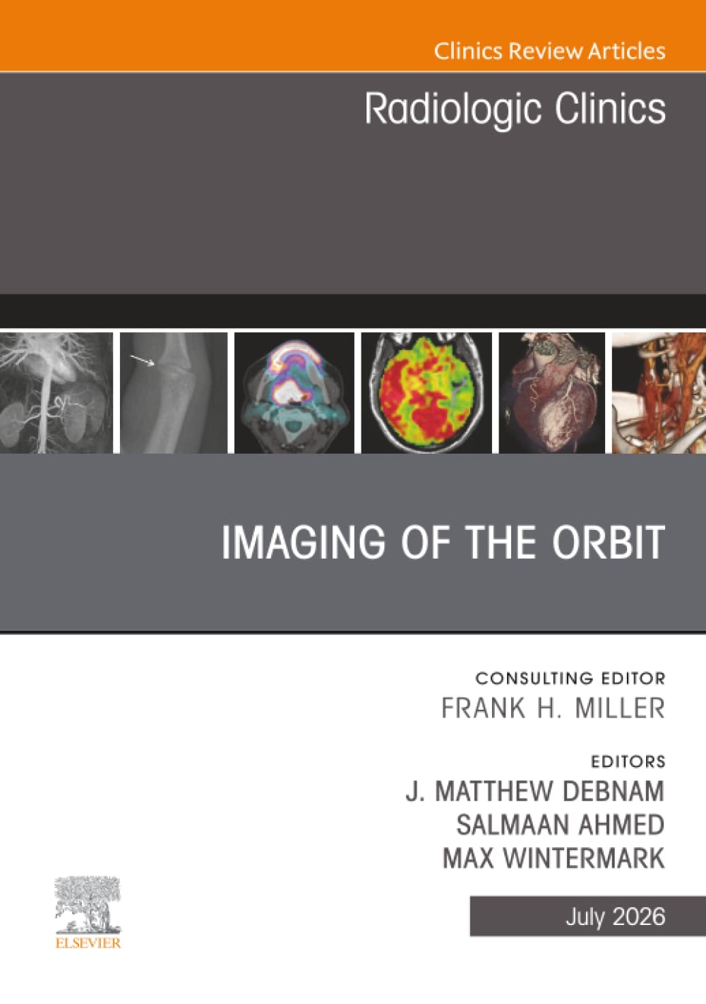 Imaging of the Orbit, An Issue of Radiologic Clinics of North America: Volume 64-4 (The Clinics: Radiology, Volume 64-4)