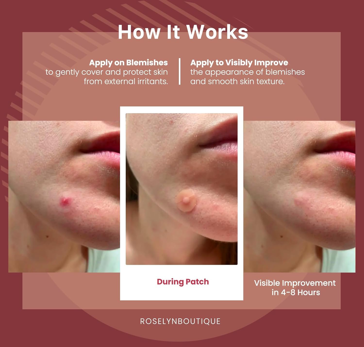 ROSELYNBOUTIQUE Pimple Patches for Face - 150 Dots 4 Sizes Hydrocolloid Spot Patches Skin-Friendly, 150 Clear Dots - Image 3
